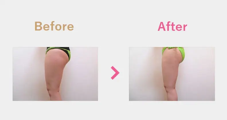Before After（横）