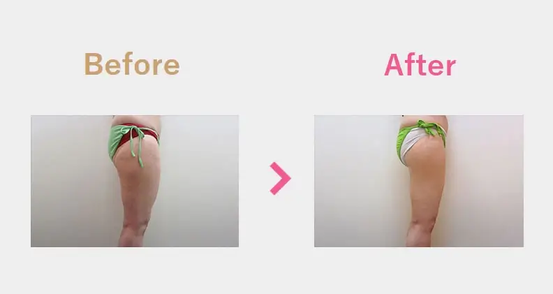 Before After（横）