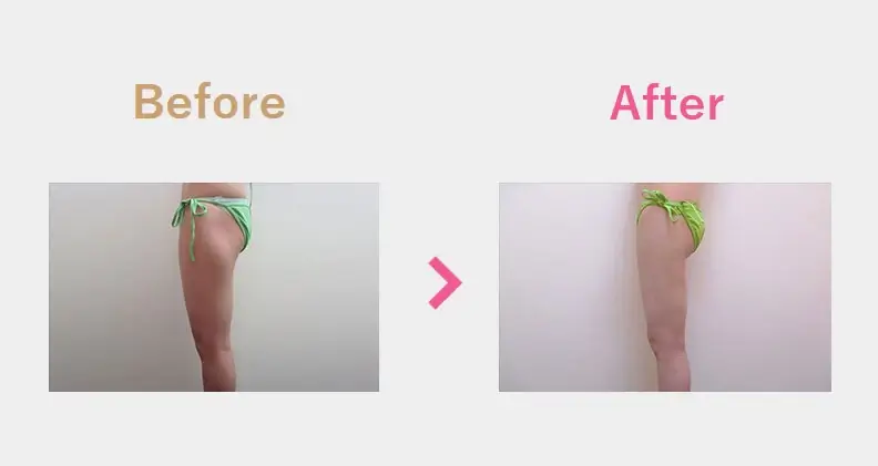 Before After（横）