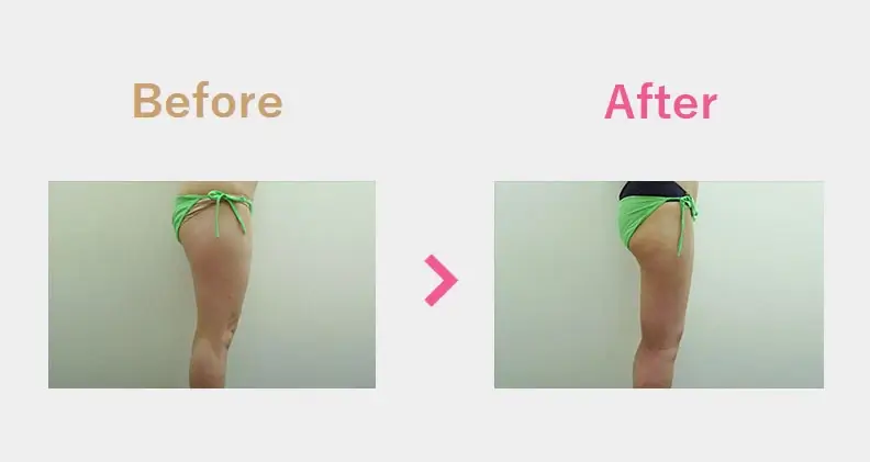 Before After（横）