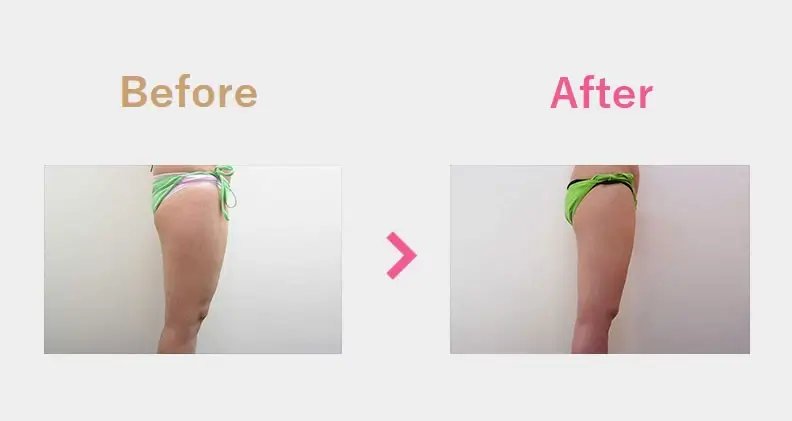 Before After（横）