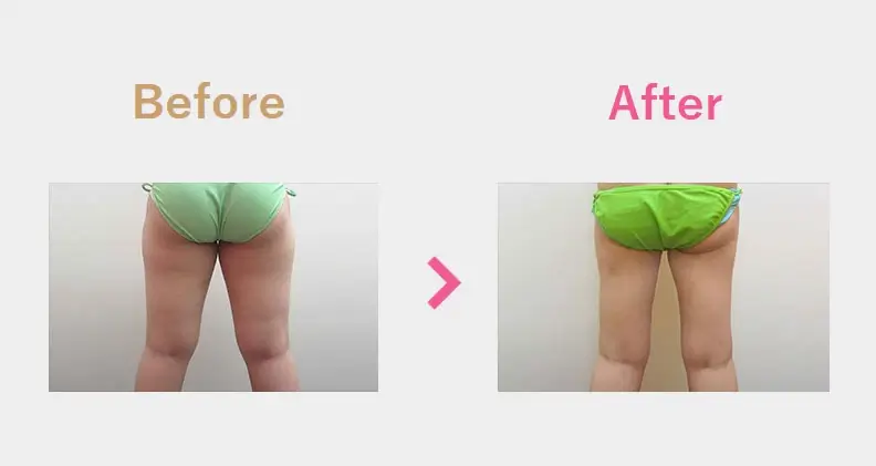 Before After（後）