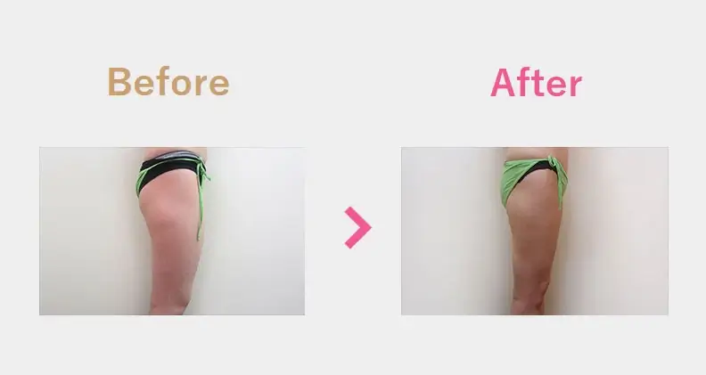 Before After（横）