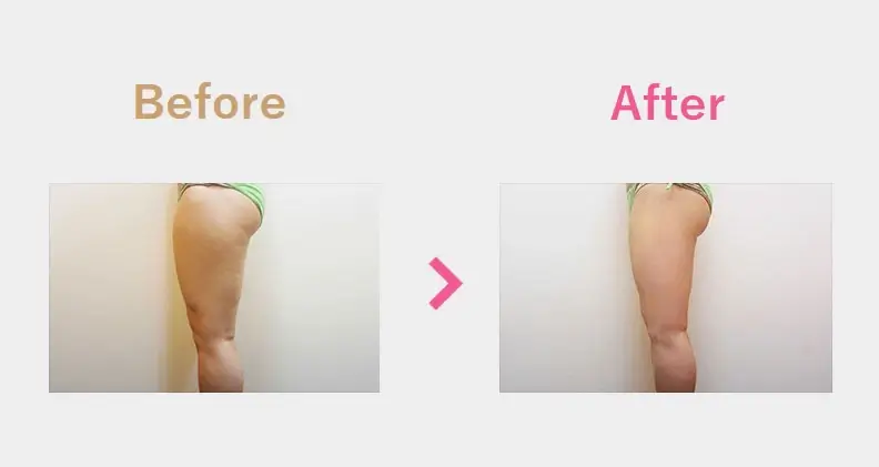 Before After（横）