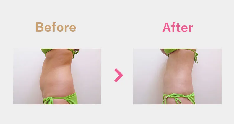 Before After（横）