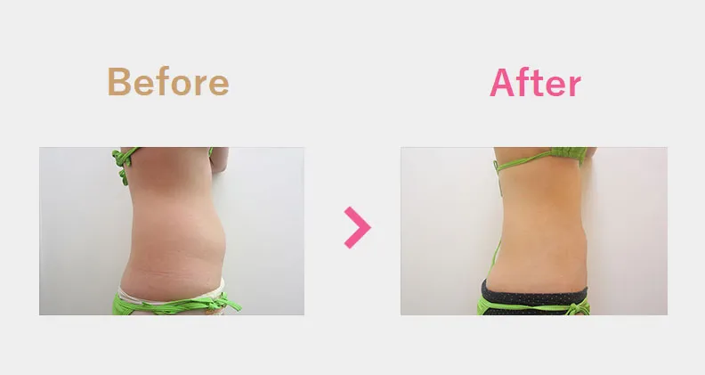 Before After（横）