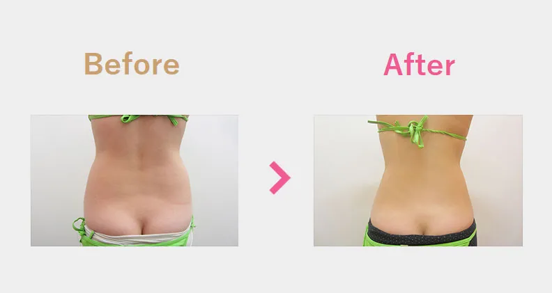 Before After（後）