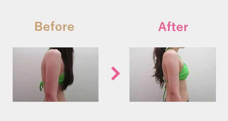 Before After（横）