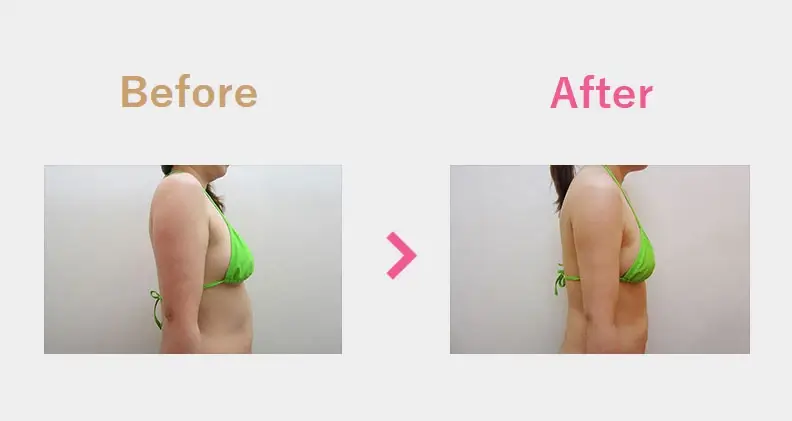Before After（横）