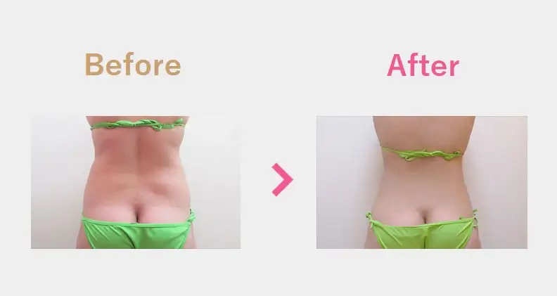 Before After（後）