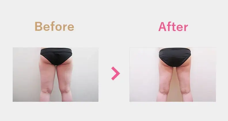 Before After（後）