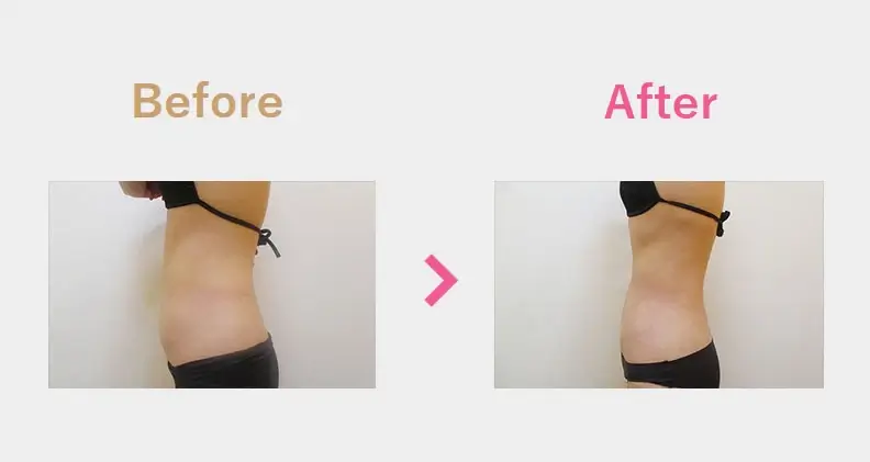 Before After（横）