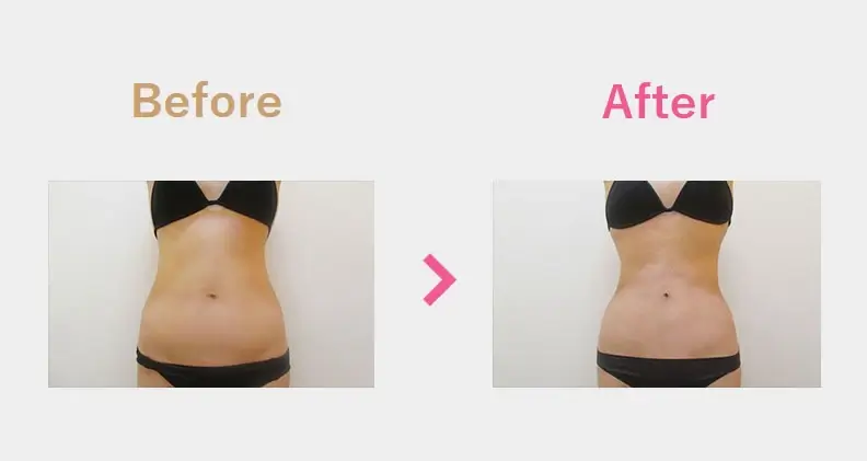 Before After（正面）