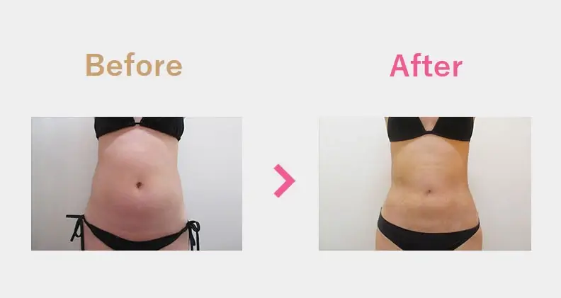 Before After（正面）