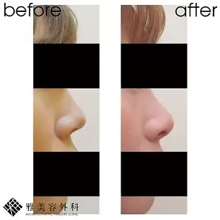 Before After（横）