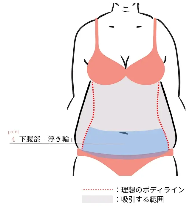POINT4. 下腹部「浮き輪」