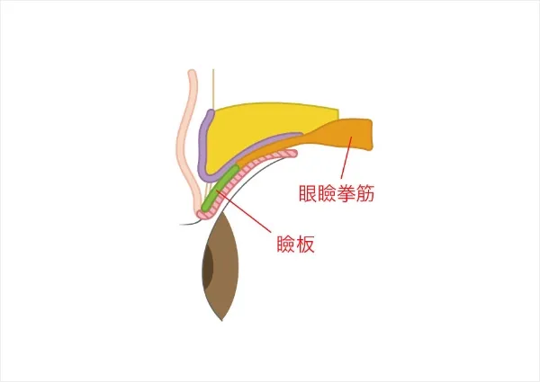 眼瞼下垂について