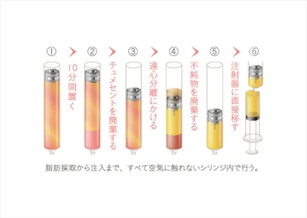 生着率を高めるならCRFという選択