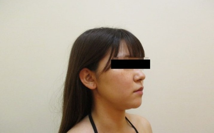 顔の症例写真一覧