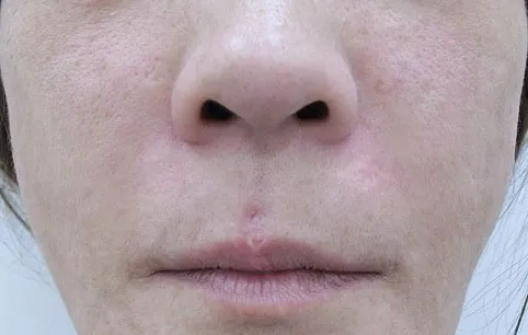 アンチエイジングの症例写真一覧