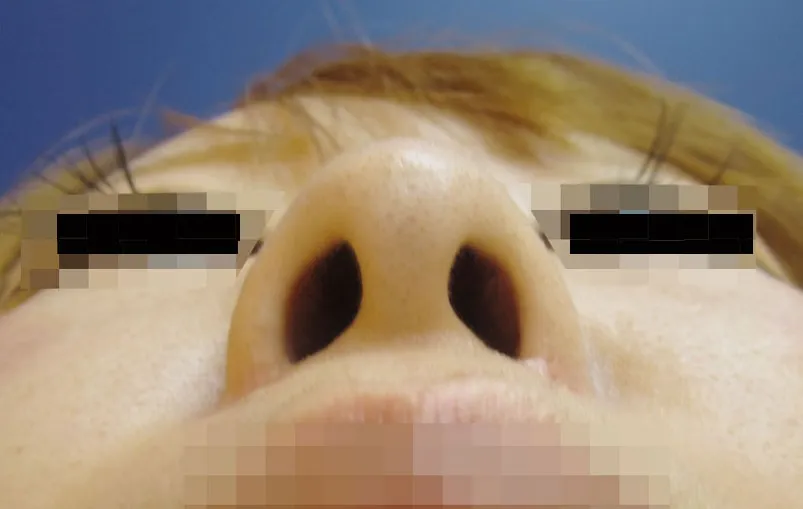 鼻・あごの症例写真一覧