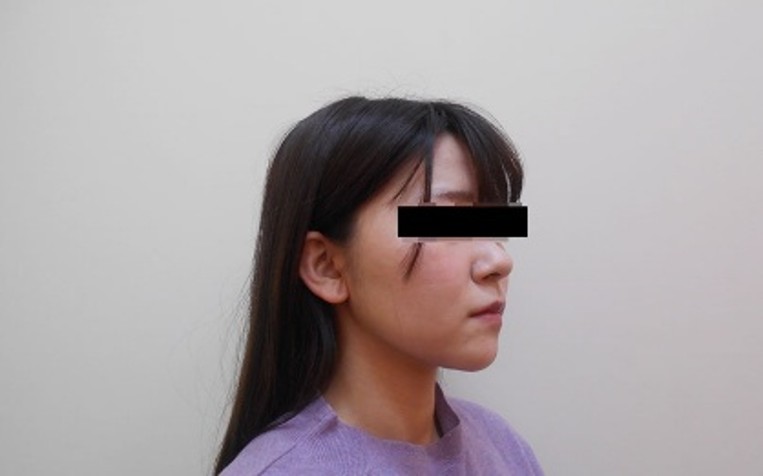 顔の症例写真一覧