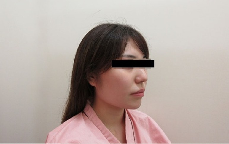 顔の症例写真一覧