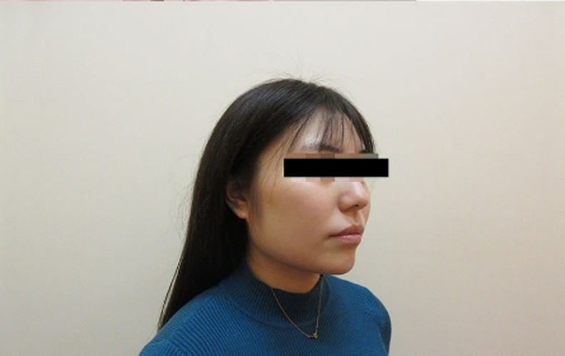 顔の症例写真一覧