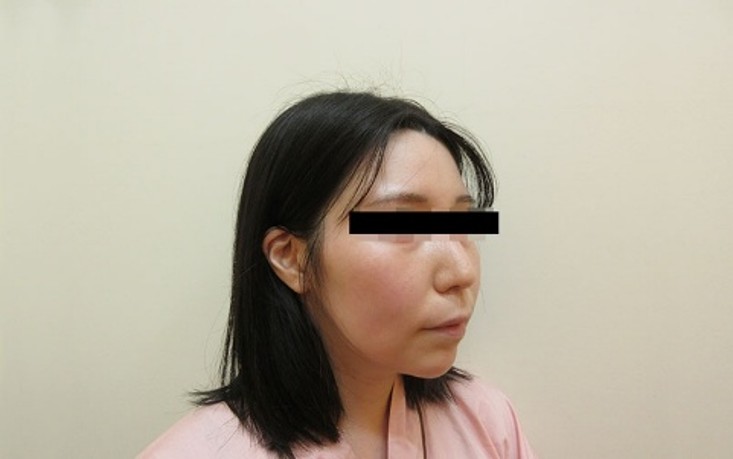 顔の症例写真一覧