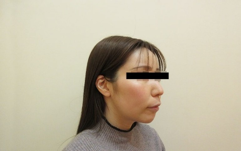 顔の症例写真一覧