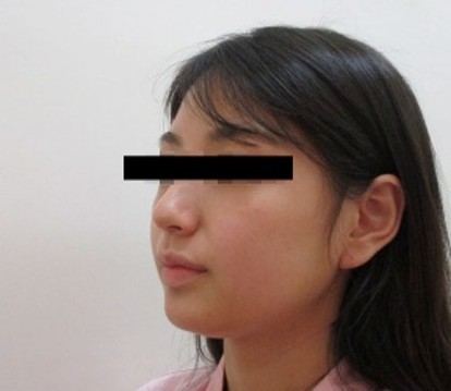 顔の症例写真一覧