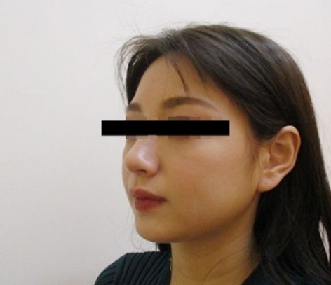 顔の症例写真一覧