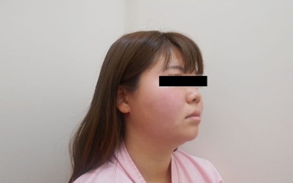 顔の症例写真一覧