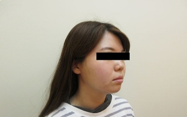 顔の症例写真一覧