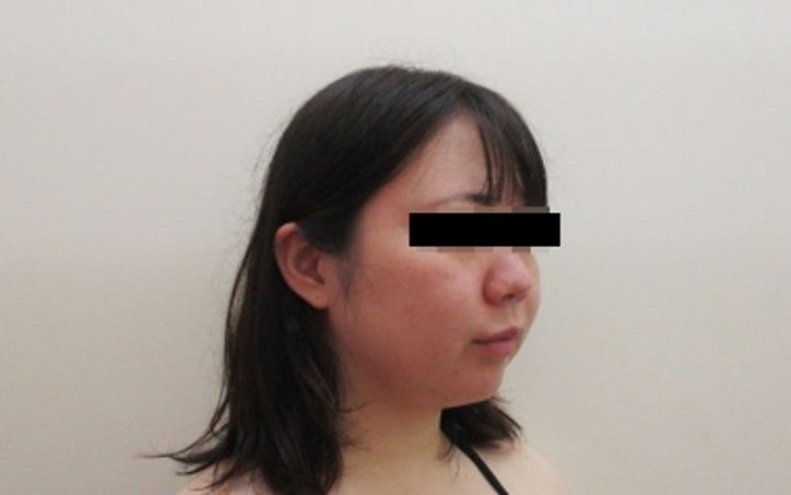 顔の症例写真一覧
