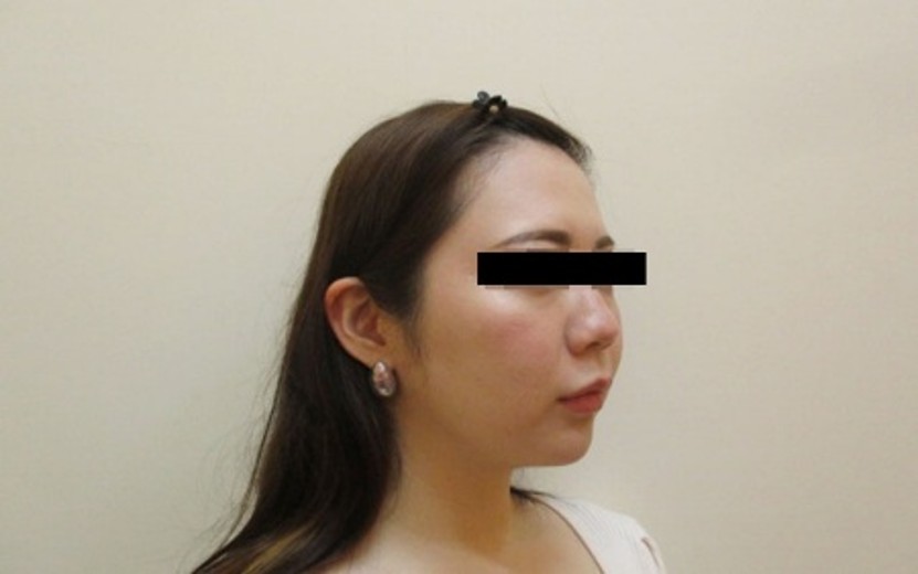 顔の症例写真一覧