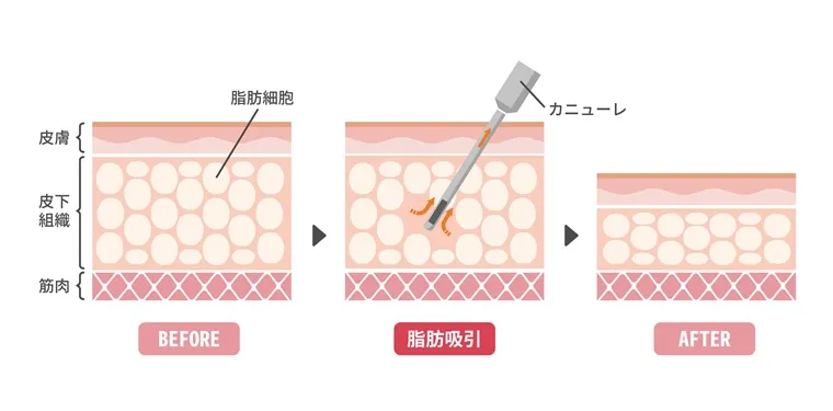 顔の引き締め効果