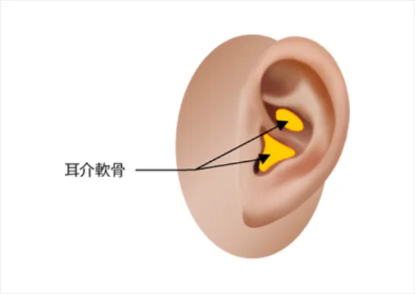 移植する軟骨について