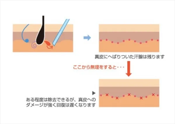 吸引法