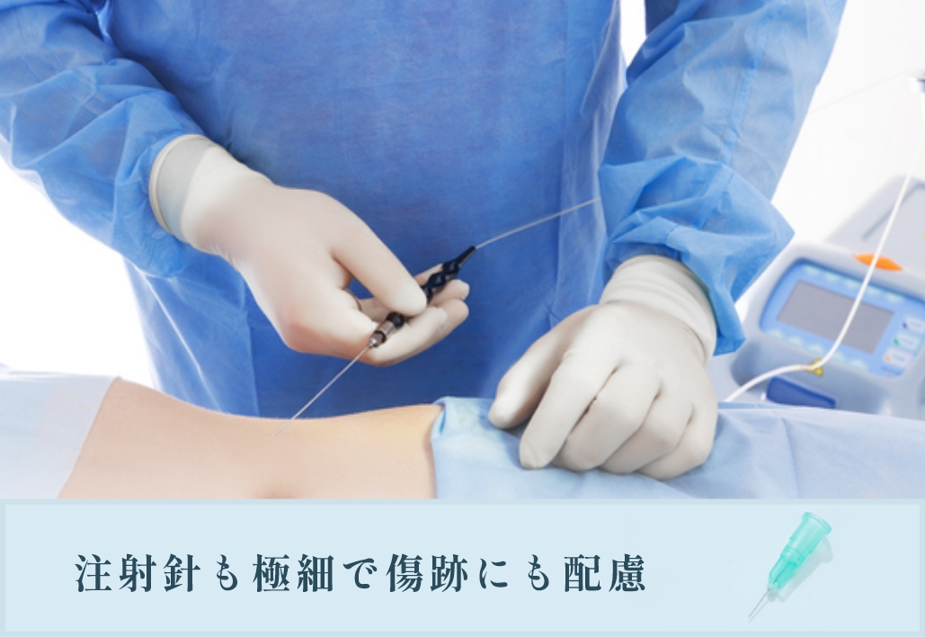 眠っている間に手術が終わり / 注射針も極細で傷跡にも配慮