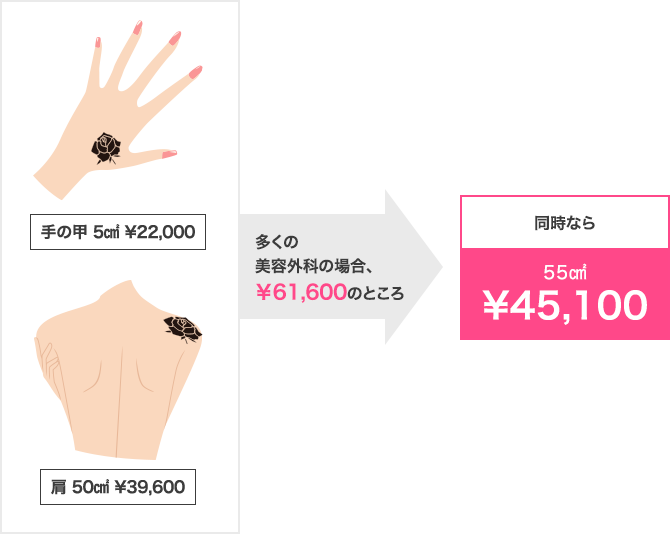 手の甲5㎠¥22,000と肩50㎠¥39,600→多くの美容外科の場合¥61,600のところ、同時なら55㎠¥45,100